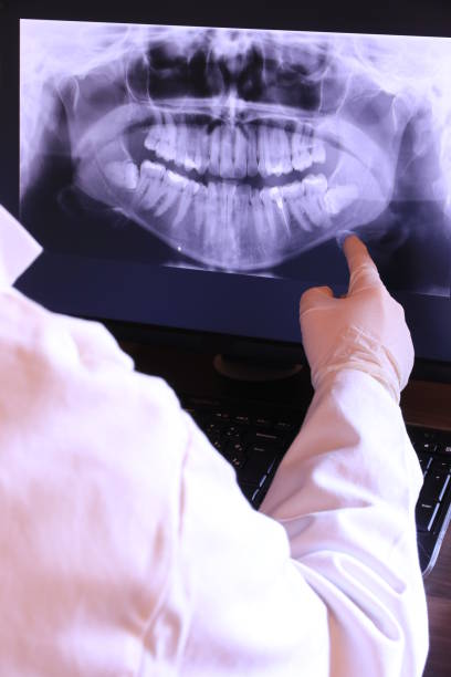 Best Urgent Care for Lost Fillings or Crowns in New Albany, MS